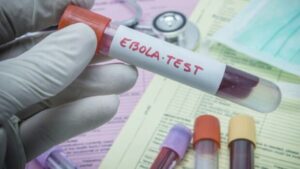 У Конго зафіксували новий спалах Еболи: медики досліджують рідкісний варіант вірусу